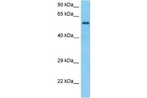 Host:  Mouse  Target Name:  TYRP1  Sample Tissue:  Mouse Heart  Antibody Dilution:  1ug/ml