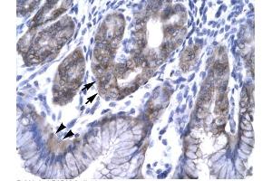 Human Stomach; Rabbit Anti-EAP30 Antibody. (SNF8 anticorps  (N-Term))