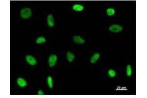 Immunostaining analysis in HeLa cells.