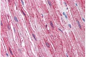 Human Heart (formalin-fixed, paraffin-embedded) stained with ADAMTS4 antibody ABIN625840 at 12 ug/ml followed by biotinylated goat anti-rabbit IgG secondary antibody ABIN481713, alkaline phosphatase-streptavidin and chromogen.