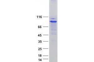 Validation with Western Blot