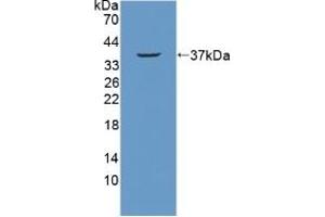 Detection of Recombinant NUP214, Mouse using Polyclonal Antibody to Nucleoporin 214 kDa (NUP214) (NUP214 anticorps  (AA 601-868))