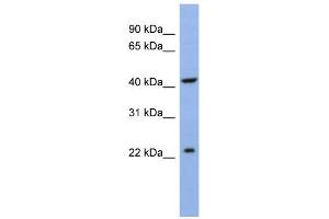 WB Suggested Anti-SLC35F1 Antibody Titration:  0. (SLC35F1 anticorps  (N-Term))