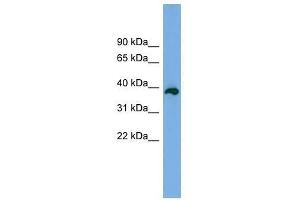 Western Blot showing DEDD2 antibody used at a concentration of 1-2 ug/ml to detect its target protein. (DEDD2 anticorps  (Middle Region))