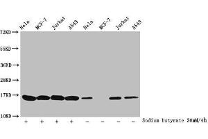 Western Blot Detected samples: Hela whole cell lysate, MCF-7 whole cell lysate, Jurkat whole cell lysate, A549 whole cell lysate, Untreated (-) or treated (+) with 30 mM sodium butyrate for 4h All lanes: HIST1H3A antibody at 1:100 Secondary Goat polyclonal to rabbit IgG at 1/40000 dilution Predicted band size: 16 kDa Observed band size: 16 kDa (HIST1H3A anticorps  (acLys27))