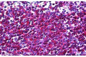 Human Spleen: Formalin-Fixed, Paraffin-Embedded (FFPE)