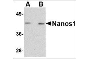 Western blot analysis of Nanos1 in rat brain tissue lysate with this product at (A) 1 and (B) 2 μg/ml. (Nanos Homolog 1 anticorps  (Center))