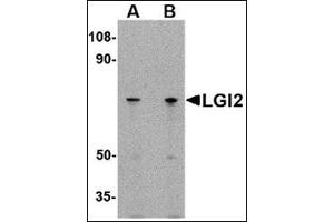 Western blot analysis of LGI2 in 293 cell lysate with this product at (A) 1 and (B) 2 μg/ml. (LGI2 anticorps  (N-Term))