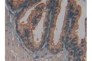 Detection of FUCa1 in Human Prostate Tissue using Polyclonal Antibody to Fucosidase Alpha L1, Tissue (FUCa1)