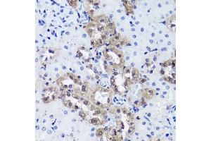 Immunohistochemistry of paraffin-embedded rat kidney using Calbindin antibody (ABIN7266004) at dilution of 1:100 (40x lens).
