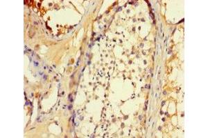 Immunohistochemistry of paraffin-embedded human testis tissue using ABIN7145717 at dilution of 1:100 (SLC25A14 anticorps  (AA 55-111))
