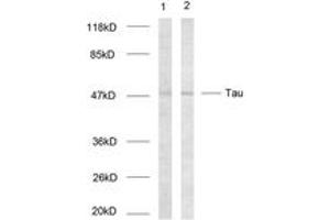 Western blot analysis of extracts from HeLa cells, using Tau (Ab-214) Antibody. (tau anticorps  (AA 501-550))