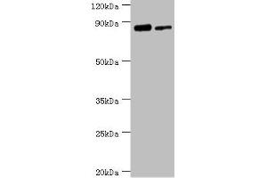 Western blot All lanes: TFIIH basal transcription factor complex helicase XPD subunit antibody at 2 μg/mL Lane 1: 293T whole cell lysate Lane 2: K562 whole cell lysate Secondary Goat polyclonal to rabbit IgG at 1/10000 dilution Predicted band size: 87, 47 kDa Observed band size: 87 kDa (ERCC2 anticorps  (AA 1-300))