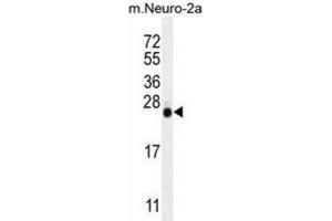Western Blotting (WB) image for anti-Lin-28 Homolog A (C. Elegans) (LIN28A) antibody (ABIN2996249) (LIN28A anticorps)