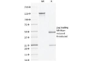 SDS-PAGE Analysis Purified AMACR / p504S Mouse Monoclonal Antibody (AMACR/1864).