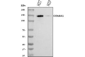 Western blot analysis of COL6A1 using anti-COL6A1 antibody (ABIN7600515).