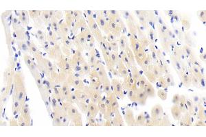 Detection of IL6 in Human Cardiac Muscle Tissue using Polyclonal Antibody to Interleukin 6 (IL6)