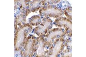 Immunohistochemistry of CAD in mouse kidney tissue with CAD antibody at 2 μg/ml. (DFFB anticorps)