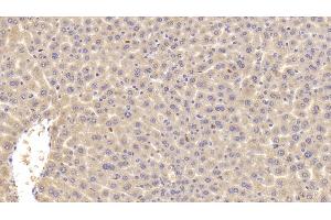 Detection of C4B in Mouse Liver Tissue using Polyclonal Antibody to Complement C4-B (C4B)