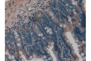 Detection of VEGFC in Mouse Small intestine Tissue using Polyclonal Antibody to Vascular Endothelial Growth Factor C (VEGFC)