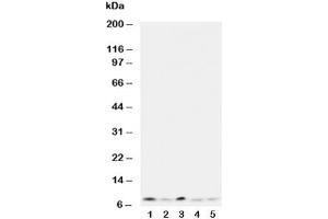 Western blot testing of Ubiquitin antibody and Lane 1:  rat thymus