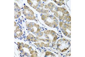 Immunohistochemistry of paraffin-embedded human stomach using ETFA antibody. (ETFA anticorps  (AA 1-333))