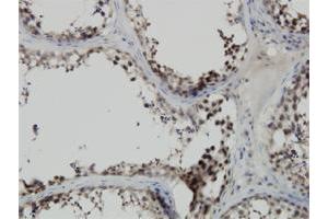 Immunoperoxidase of monoclonal antibody to PBK on formalin-fixed paraffin-embedded human testis.