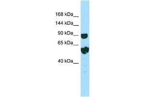 WB Suggested Anti-RPTN Antibody Titration: 1. (Repetin anticorps  (C-Term))