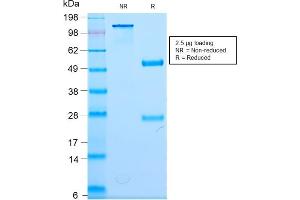 SDS-PAGE Analysis Purified Neurofilament Rabbit Monoclonal Antibody (NEFL/2983R). (Recombinant NEFL anticorps)