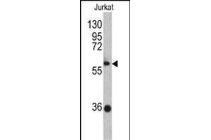 Western blot analysis of ZBTB2 antibody (C-term) (ABIN390710 and ABIN2840992) in Jurkat cell line lysates (35 μg/lane). (ZBTB2 anticorps  (C-Term))