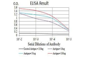 Black line: Control Antigen (100 ng),Purple line: Antigen (10 ng), Blue line: Antigen (50 ng), Red line:Antigen (100 ng) (PDGFRA anticorps  (AA 179-361))