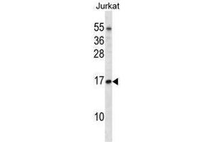 TCEB1 Antibody (C-term) western blot analysis in Jurkat cell line lysates (35 µg/lane). (TCEB1 anticorps  (C-Term))
