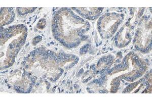 ABIN6274207 at 1/100 staining Human prostate tissue by IHC-P.