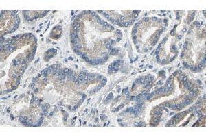ABIN6274207 at 1/100 staining Human prostate tissue by IHC-P. (DTYMK anticorps  (Internal Region))