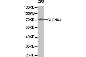 Western Blotting (WB) image for anti-Chloride Channel Ka (CLCNKA) antibody (ABIN1871886) (CLCNKA anticorps)
