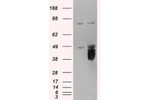 Image no. 2 for anti-Tissue Factor Pathway Inhibitor (Lipoprotein-Associated Coagulation Inhibitor) (TFPI) (C-Term) antibody (ABIN374077) (TFPI anticorps  (C-Term))