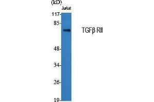 Western Blotting (WB) image for anti-Transforming Growth Factor, beta Receptor II (70/80kDa) (TGFBR2) (Internal Region) antibody (ABIN3187248)