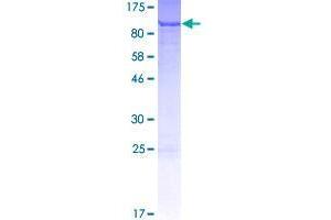 Image no. 1 for Small G Protein Signaling Modulator 3 (SGSM3) (AA 1-749) protein (GST tag) (ABIN1319848)