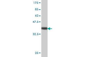 Western Blot detection against Immunogen (37.