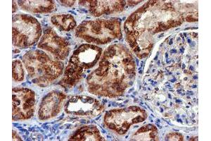 Image no. 7 for anti-NADH Dehydrogenase (Ubiquinone) 1 beta Subcomplex, 9, 22kDa (NDUFB9) (AA 3-179) antibody (ABIN1491359)