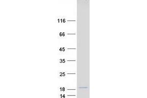 Validation with Western Blot