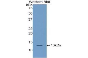 Detection of Recombinant PABPC1L, Human using Polyclonal Antibody to Poly A Binding Protein Cytoplasmic 1 Like Protein (PABPC1L) (PABPC1L anticorps  (AA 514-612))