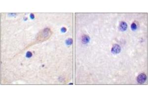Immunohistochemistry (IHC) image for anti-Parkinson Protein 2, E3 Ubiquitin Protein Ligase (Parkin) (PARK2) (AA 101-150) antibody (ABIN2888688) (Parkin anticorps  (AA 101-150))
