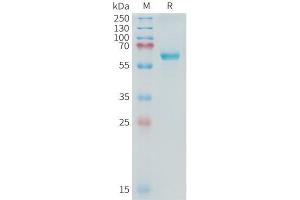 Cynomolgus ALPP Protein, His Tag on SDS-PAGE under reducing condition.
