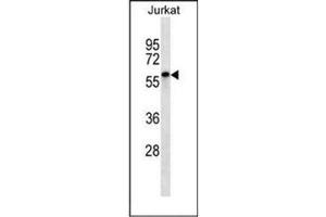 Western blot analysis of ENOX2 Antibody (N-term) in Jurkat cell line lysates (35ug/lane). (ENOX2 anticorps  (N-Term))