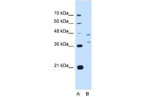 EVI2B antibody used at 2. (EVI2B anticorps  (Middle Region))