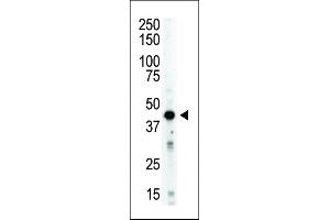 Antibody is used in Western blot to detect STK12 in mouse spleen tissue lysate. (Aurora Kinase B anticorps  (AA 283-313))