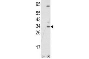 Western blot analysis of SNAI1 antibody and 293 cell lysate (2 ug/lane) either nontransfected (Lane 1) or transiently transfected with the SNAIL gene (2). (SNAIL anticorps  (AA 1-30))