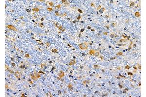 ABIN6257466 and ABIN6274772 at 1/100 staining Rat brain tissue by IHC-P.
