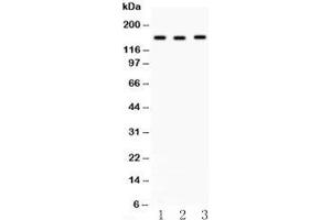 Western blot testing of ACE antibody and (1) HeLa, (2) A549 and (3) 22RV1 lysate.